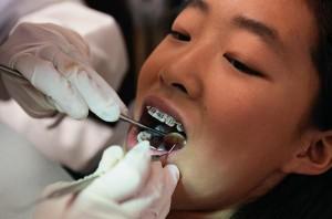 Understanding Medicaids Coverage for Orthodontic‍ Treatment in Virginia